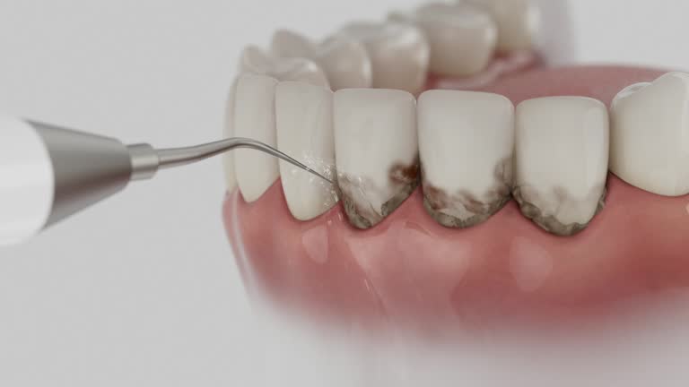 Reliable Invisalign Clear Aligners contractor in Conecuh County County, AL by Dentist Open Now